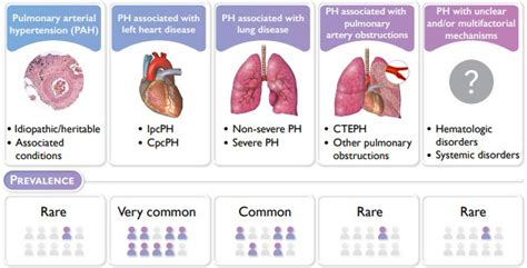 Pulmonary .